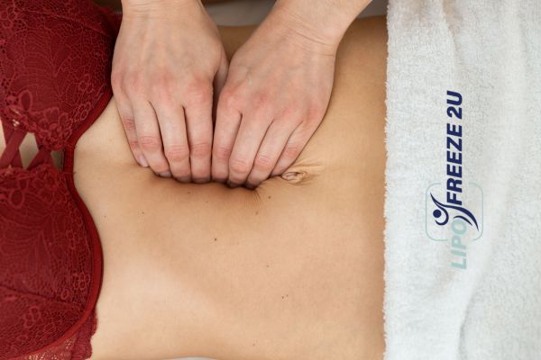 diastasis recti treatment Rochester