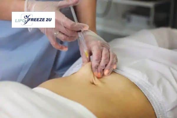 Fat Dissolving Injections Rochester & Weight loss medication
