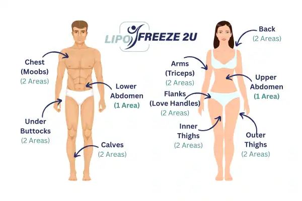 Areas you can have fat freezing treatment Rochester