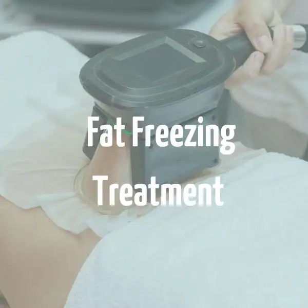 fat freezing treatment Rochester