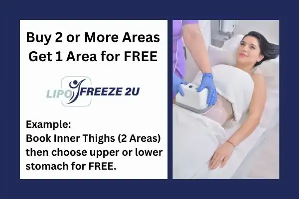 fat freezing prices Rochester