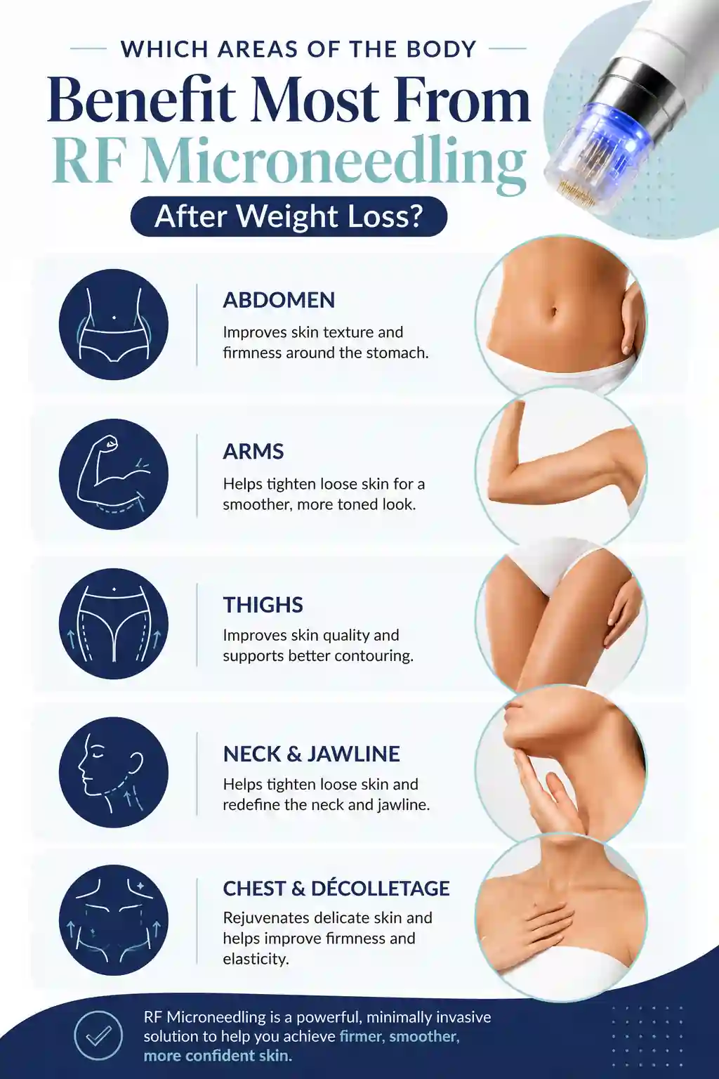 Which Areas of the Body Benefit Most From RF Microneedling After Weight Loss Rochester
